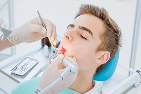 What are the different types of dental fillings?