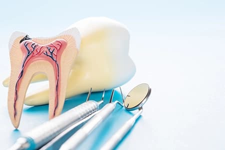 services_dental_interior_root_canals